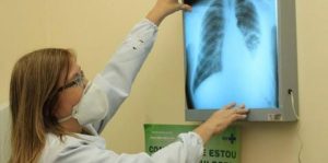Imagem da notícia - Dia Nacional de Combate à Tuberculose: SES-AM esclarece sobre meios de prevenção, sintomas e tratamento