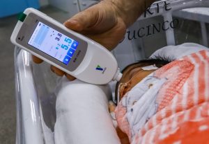 SES-AM inova no diagnóstico de icterícia neonatal, com uso de equipamento de ponta na Maternidade Ana Braga